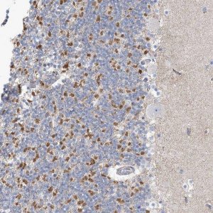 Anti-MTHFD2L antibody produced in rabbit 