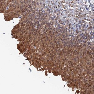 Anti-MTHFSD antibody produced in rabbit 