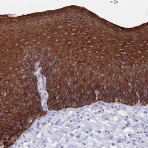 Anti-MTMR2 antibody produced in rabbit 