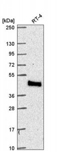 Anti-MTMR9 antibody produced in rabbit 