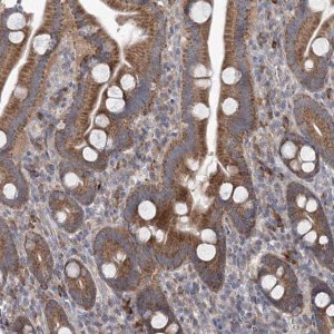 Anti-MTRF1L antibody produced in rabbit 