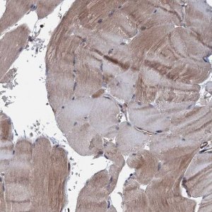 Anti-MTRR antibody produced in rabbit 