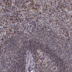 Anti-MTSS1 antibody produced in rabbit 