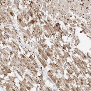 Anti-MTUS2 antibody produced in rabbit 