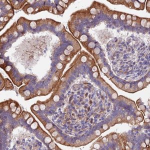 Anti-MVB12A antibody produced in rabbit 