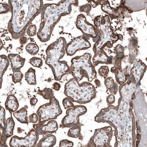 Anti-MXRA8 antibody produced in rabbit 