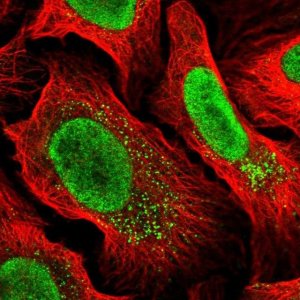 Anti-MYCBP2 antibody produced in rabbit 