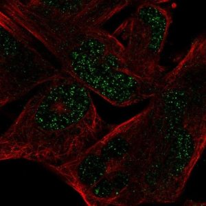 Anti-MYCL antibody produced in rabbit HPA063132-100UL