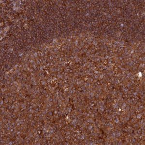 Anti-MYO9B antibody produced in rabbit 