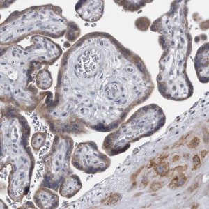 Anti-MYOC antibody produced in rabbit 