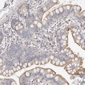 Anti-MYOM3 antibody produced in rabbit 