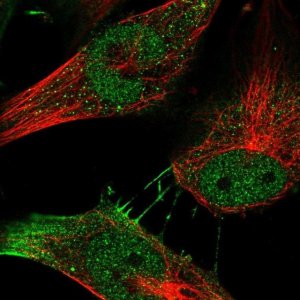 Anti-MYSM1 antibody produced in rabbit 
