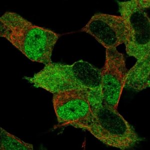 Anti-MYT1 antibody produced in rabbit 