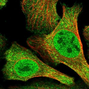 Anti-N4BP2 antibody produced in rabbit 