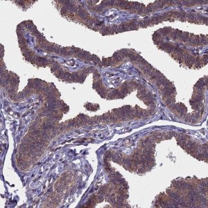 Anti-NAA10 antibody produced in rabbit 