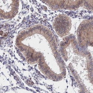 Anti-NAA10 antibody produced in rabbit 