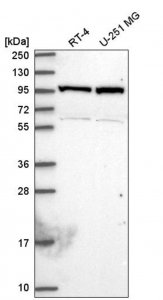 Anti-NAA15 antibody produced in rabbit 