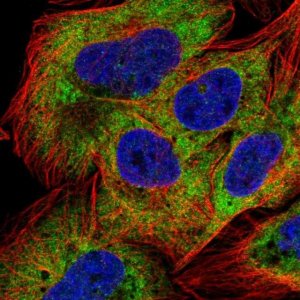 Anti-NAA20 antibody produced in rabbit 