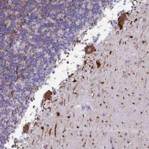 Anti-NAA30 antibody produced in rabbit 
