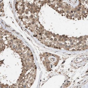 Anti-NAA35 antibody produced in rabbit 