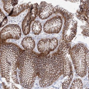 Anti-NAA40 antibody produced in rabbit 