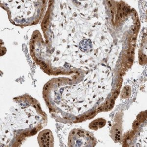 Anti-NAB2 antibody produced in rabbit 