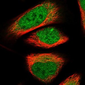 Anti-NAB2 antibody produced in rabbit 