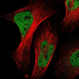 Anti-NACC1 antibody produced in rabbit 