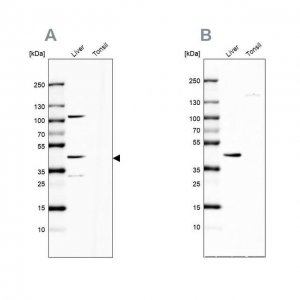 Anti-NADK2 antibody produced in rabbit 