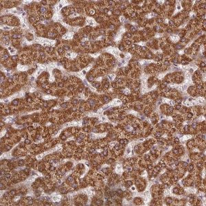 Anti-NADK2 antibody produced in rabbit 
