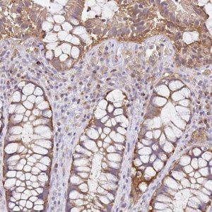Anti-NADSYN1 antibody produced in rabbit 