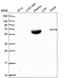 Anti-NARF antibody produced in rabbit 