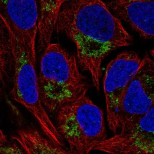 Anti-NAT14 antibody produced in rabbit 