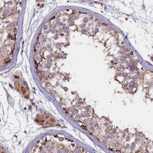 Anti-NAT6 antibody produced in rabbit 