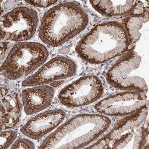 Anti-NAV1 antibody produced in rabbit 