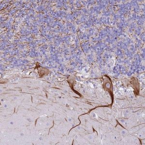 Anti-NBPF15 antibody produced in rabbit 