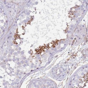 Anti-NBPF3 antibody produced in rabbit 