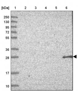 Anti-NBPF3 antibody produced in rabbit HPA046971-100UL
