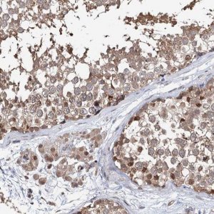 Anti-NCAPD2 antibody produced in rabbit HPA037363-100UL
