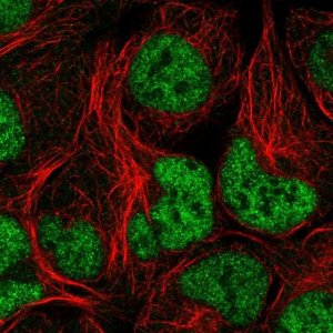 Anti-NCAPD3 antibody produced in rabbit 