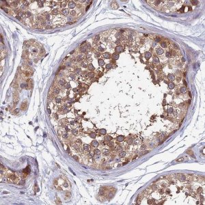 Anti-NCAPG antibody produced in rabbit 