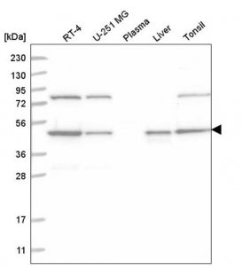 Anti-NCK1 antibody produced in rabbit 