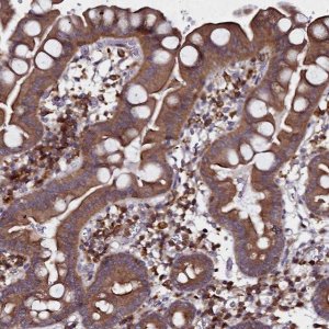 Anti-NCKAP1L antibody produced in rabbit 