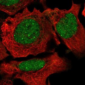 Anti-NCOA2 antibody produced in rabbit 