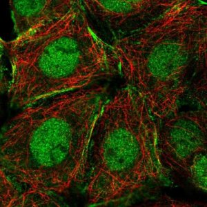 Anti-NCOA5 antibody produced in rabbit 
