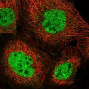 Anti-NCOA6 antibody produced in rabbit 