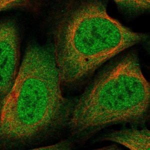 Anti-NCOR1 antibody produced in rabbit 