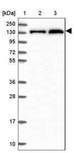 Anti-NCOR1 antibody produced in rabbit HPA050288-100UL