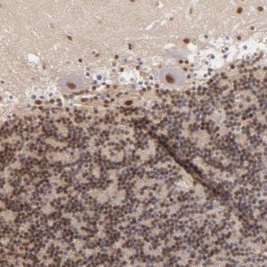 Anti-NCOR2 antibody produced in rabbit 