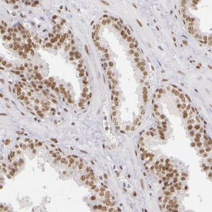 Anti-NCOR2 antibody produced in rabbit 